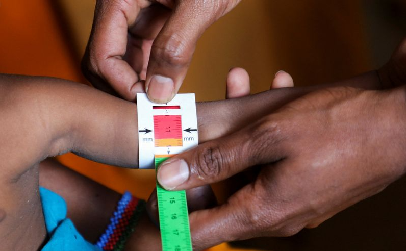 Somali child hunger crisis deepens as facilities close due to aid cuts, UNICEF says